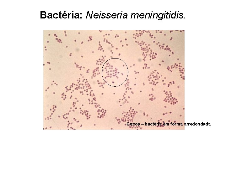 Bactéria: Neisseria meningitidis. Cocos – bactéria em forma arredondada 