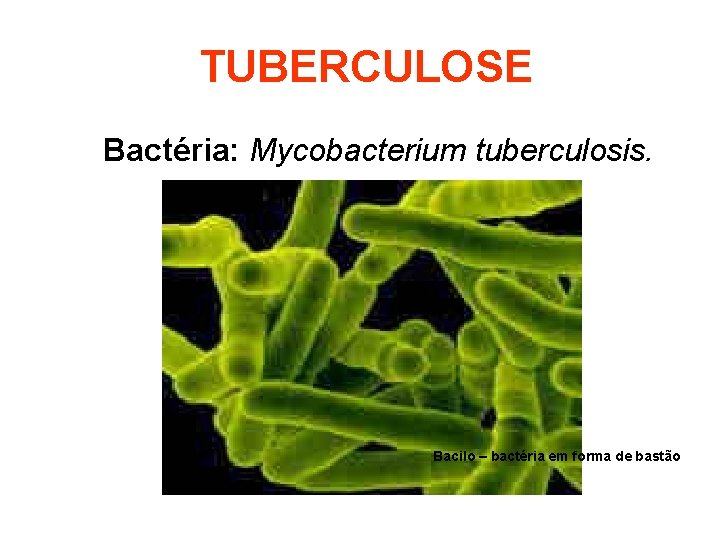 TUBERCULOSE Bactéria: Mycobacterium tuberculosis. Bacilo – bactéria em forma de bastão 