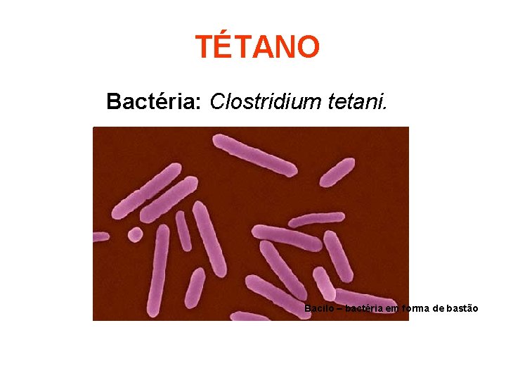 TÉTANO Bactéria: Clostridium tetani. Bacilo – bactéria em forma de bastão 