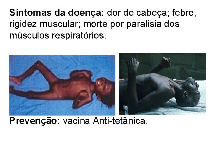 Sintomas da doença: dor de cabeça; febre, rigidez muscular; morte por paralisia dos músculos