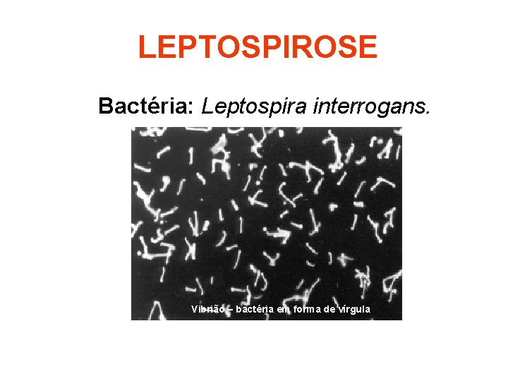 LEPTOSPIROSE Bactéria: Leptospira interrogans. Vibrião – bactéria em forma de vírgula 