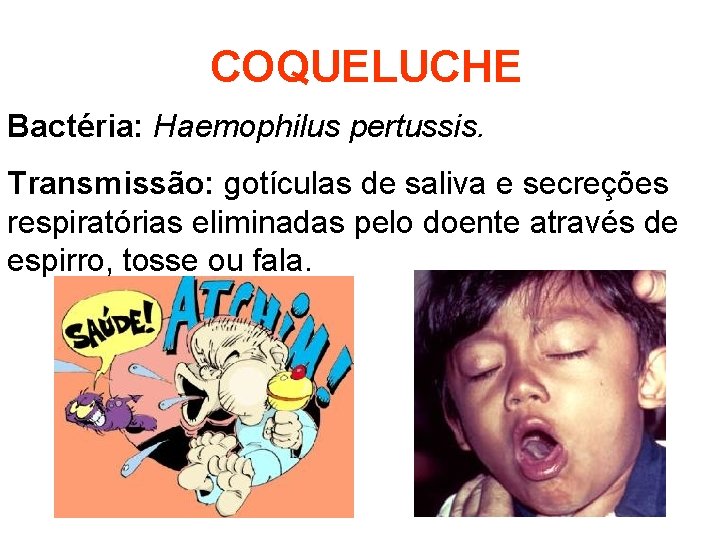 COQUELUCHE Bactéria: Haemophilus pertussis. Transmissão: gotículas de saliva e secreções respiratórias eliminadas pelo doente