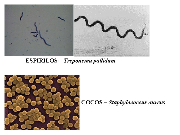 ESPIRILOS – Treponema pallidum COCOS – Staphylococcus aureus 