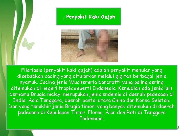 . Penyakit Kaki Gajah Filariasis (penyakit kaki gajah) adalah penyakit menular yang disebabkan cacing