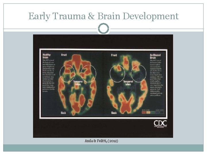 Early Trauma & Brain Development Anda & Felitti, (2012) 