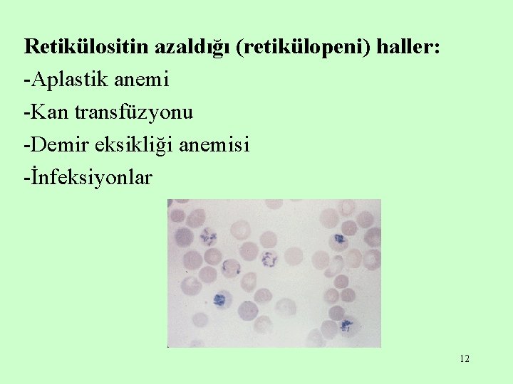 Retikülositin azaldığı (retikülopeni) haller: -Aplastik anemi -Kan transfüzyonu -Demir eksikliği anemisi -İnfeksiyonlar 12 