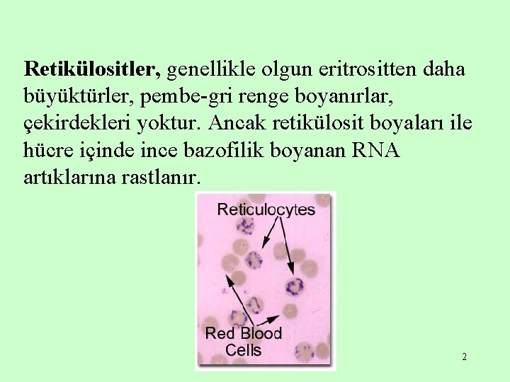 Retikülositler, genellikle olgun eritrositten daha büyüktürler, pembe-gri renge boyanırlar, çekirdekleri yoktur. Ancak retikülosit boyaları
