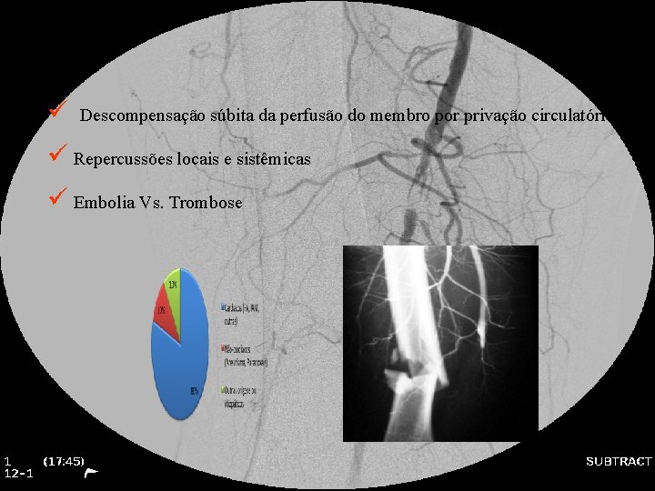 ü Descompensação súbita da perfusão do membro por privação circulatória ü Repercussões locais e