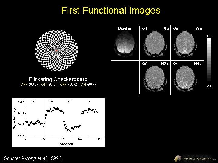 First Functional Images Flickering Checkerboard OFF (60 s) - ON (60 s) - OFF