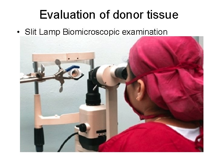Evaluation of donor tissue • Slit Lamp Biomicroscopic examination 