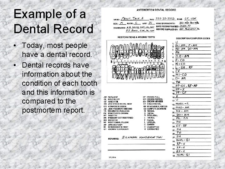 Example of a Dental Record • Today, most people have a dental record. •