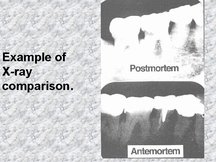 Example of X-ray comparison. 