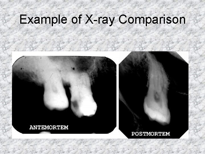 Example of X-ray Comparison 
