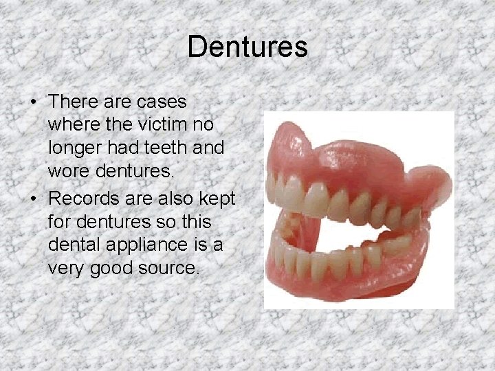 Dentures • There are cases where the victim no longer had teeth and wore
