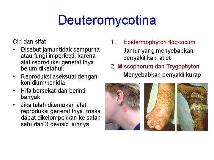 Deuteromycotina Ciri dan sifat • Disebut jamur tidak sempurna atau fungi imperfecti, karena alat
