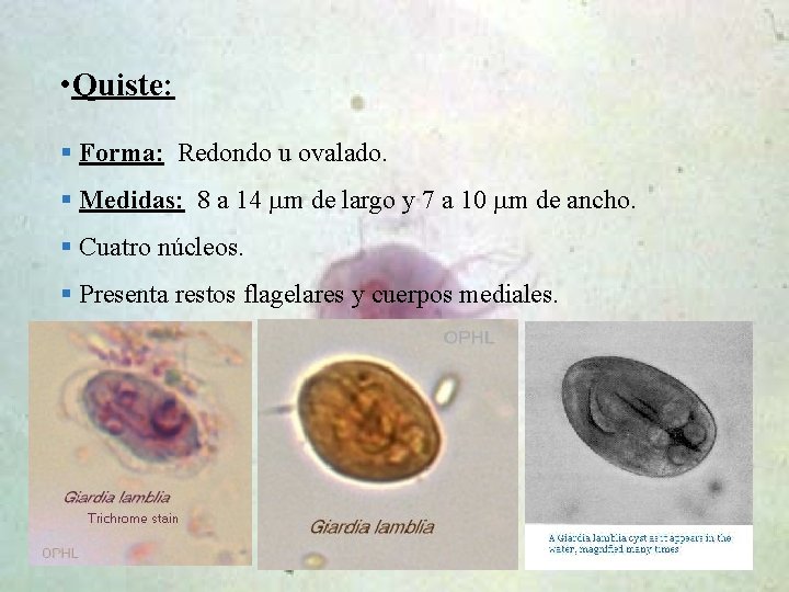  • Quiste: § Forma: Redondo u ovalado. § Medidas: 8 a 14 m