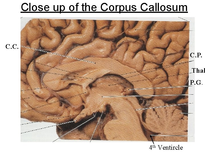 Close up of the Corpus Callosum C. C. C. P. Thal P. G. 4