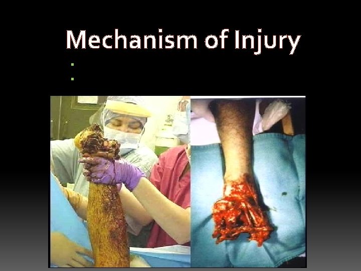 Mechanism of Injury Unexpected start-up of the equipment Release of stored energy 