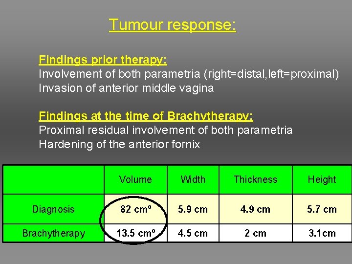 Tumour response: Findings prior therapy: Involvement of both parametria (right=distal, left=proximal) Invasion of anterior