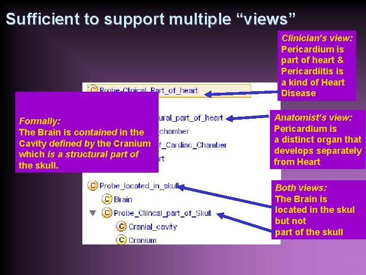 Sufficient to support multiple “views” Clinician’s view: Pericardium is part of heart & Pericardiitis