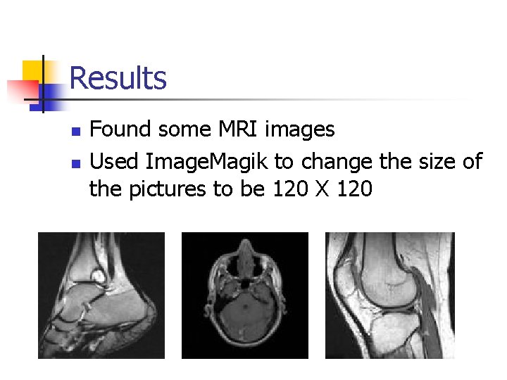 Results n n Found some MRI images Used Image. Magik to change the size