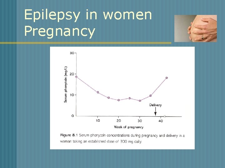 Epilepsy in women Pregnancy 