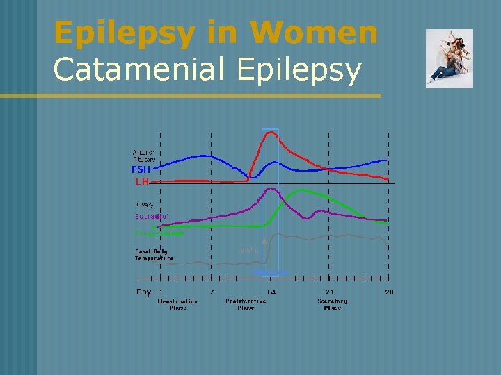 Epilepsy in Women Catamenial Epilepsy 