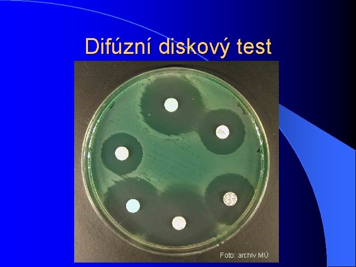 Difúzní diskový test Foto: archiv MÚ 