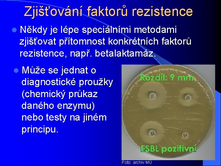 Zjišťování faktorů rezistence l Někdy je lépe speciálními metodami zjišťovat přítomnost konkrétních faktorů rezistence,