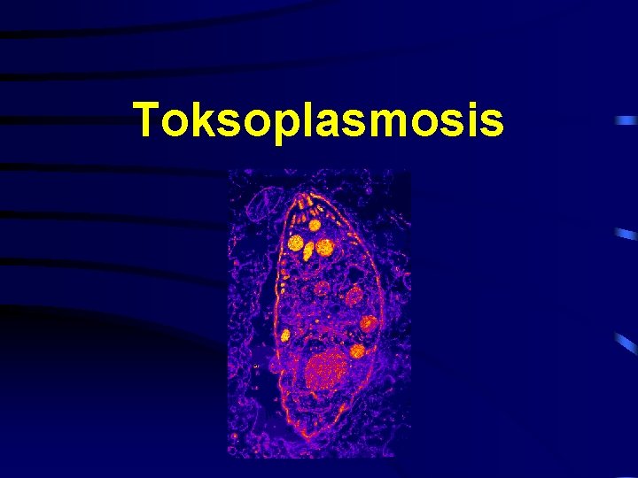 Toksoplasmosis 