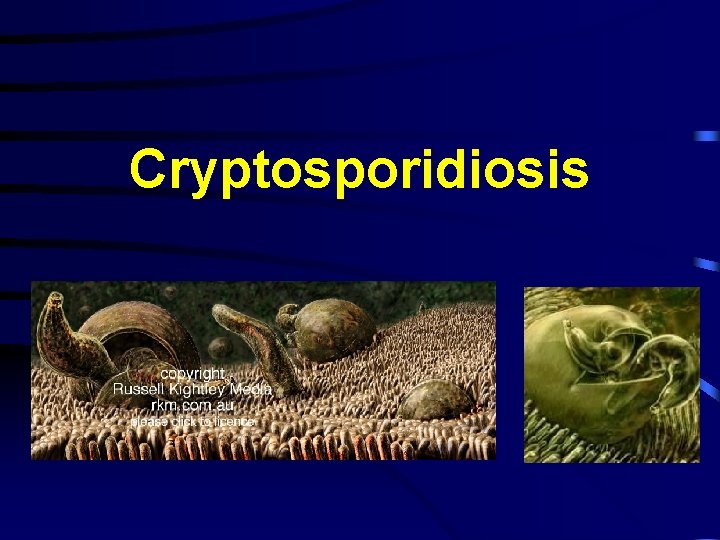 Cryptosporidiosis 