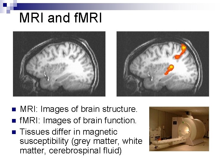 MRI and f. MRI n n n MRI: Images of brain structure. f. MRI: