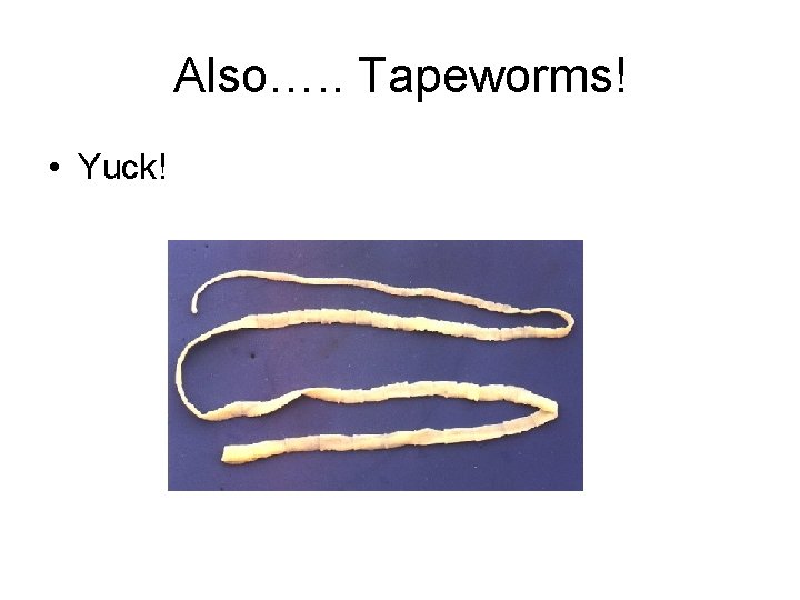 Also…. . Tapeworms! • Yuck! 