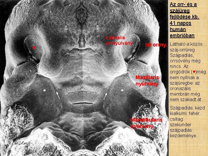♥ Lateralis orrnyúlvány Az orr- és a szájüreg fejlődése kb. 41 napos humán embrióban