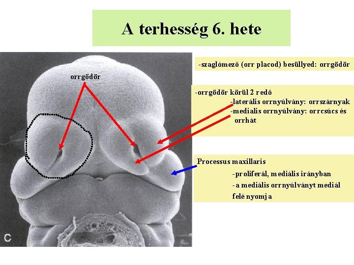 A terhesség 6. hete -szaglómező (orr placod) besüllyed: orrgödör -orrgödör körül 2 redő -laterális