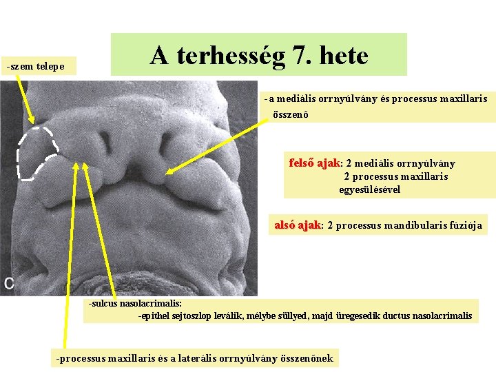 -szem telepe A terhesség 7. hete -a mediális orrnyúlvány és processus maxillaris összenő felső