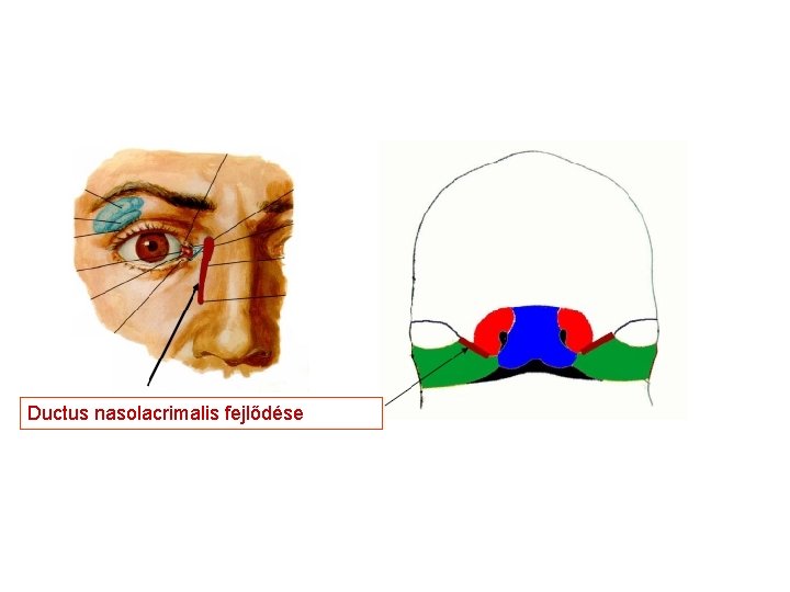 Ductus nasolacrimalis fejlődése 