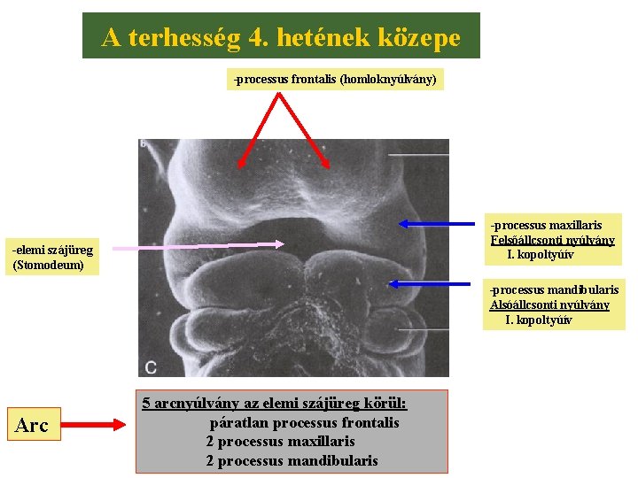 A terhesség 4. hetének közepe -processus frontalis (homloknyúlvány) -processus maxillaris Felsőállcsonti nyúlvány I. kopoltyúív