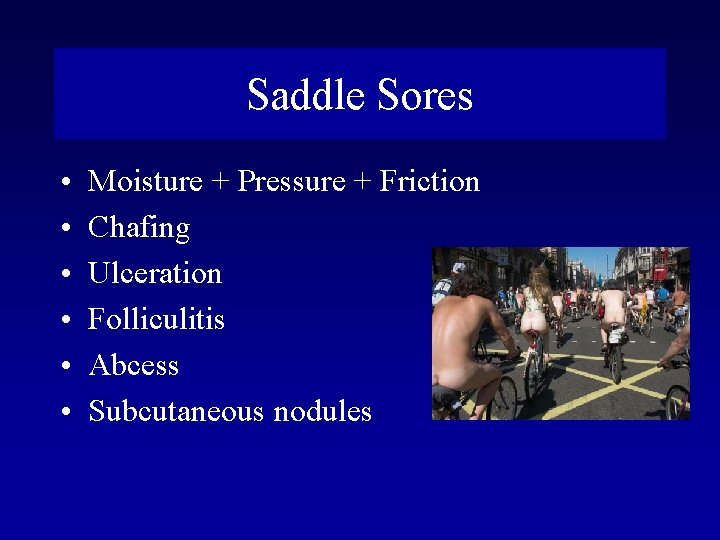 Saddle Sores • • • Moisture + Pressure + Friction Chafing Ulceration Folliculitis Abcess