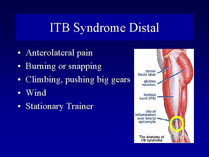 ITB Syndrome Distal • • • Anterolateral pain Burning or snapping Climbing, pushing big