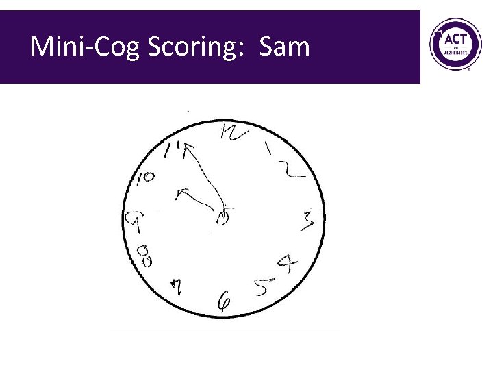 Mini-Cog Scoring: Sam Mini-Cog Scoring: Sam