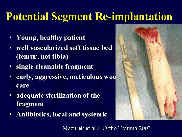 Potential Segment Re-implantation • Young, healthy patient • well vascularized soft tissue bed (femur,