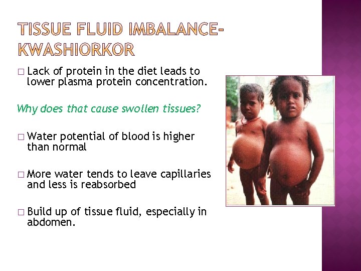 � Lack of protein in the diet leads to lower plasma protein concentration. Why