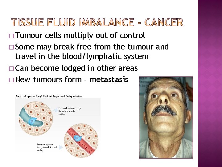 � Tumour cells multiply out of control � Some may break free from the