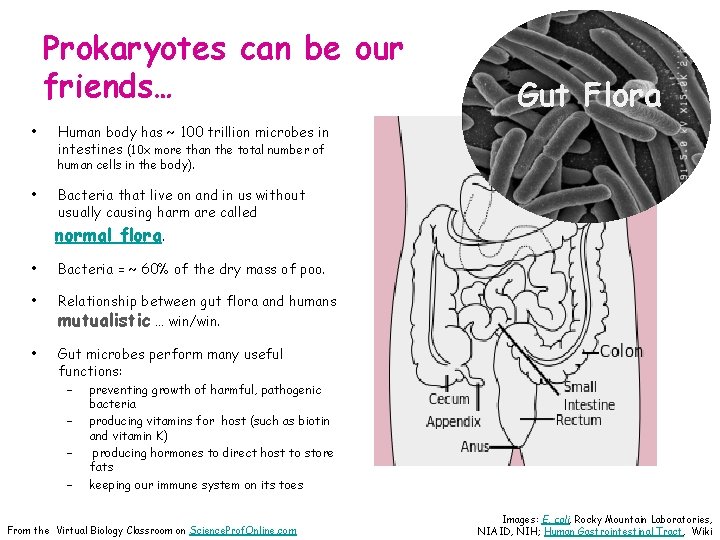 Prokaryotes can be our friends… • Gut Flora Human body has ~ 100 trillion