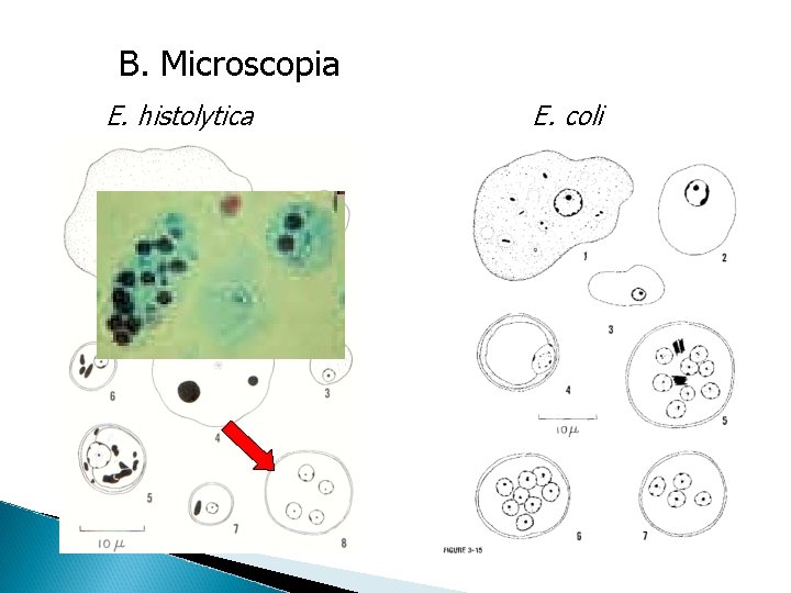 B. Microscopia E. histolytica E. coli 