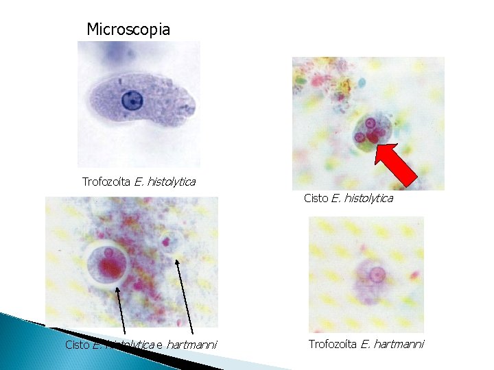 Microscopia Trofozoíta E. histolytica Cisto E. histolytica e hartmanni Trofozoíta E. hartmanni 