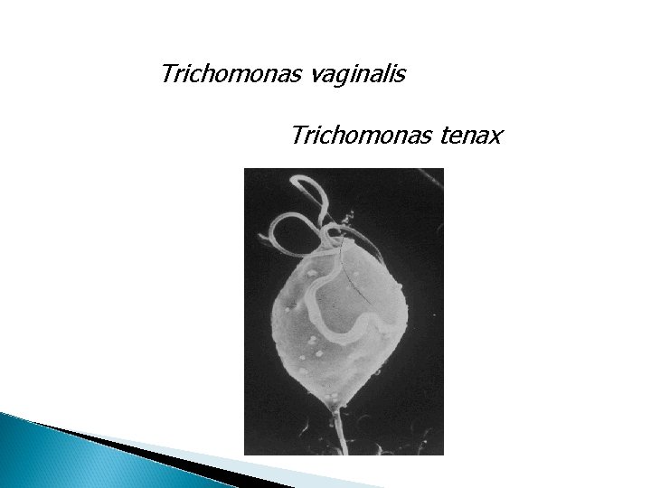 Trichomonas vaginalis Trichomonas tenax 