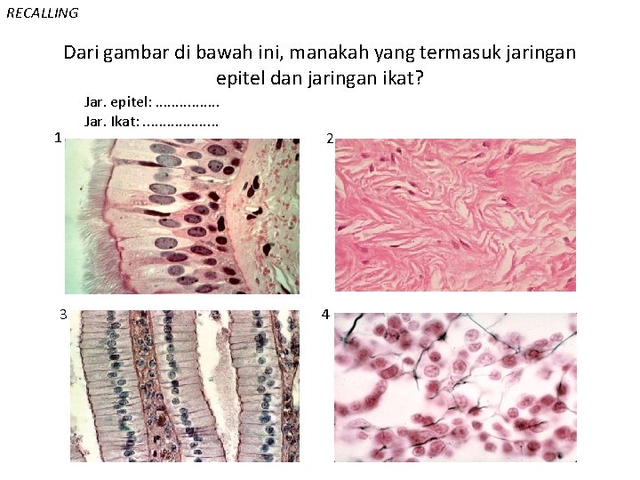 RECALLING Dari gambar di bawah ini, manakah yang termasuk jaringan epitel dan jaringan ikat?