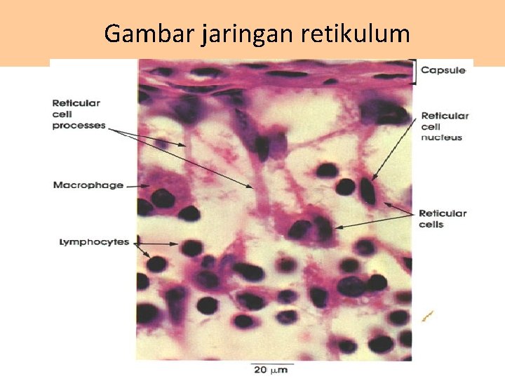Gambar jaringan retikulum 